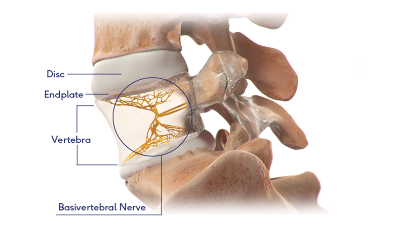 spine parts